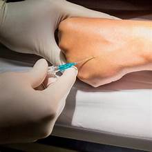 IV Drips & Cannulation
